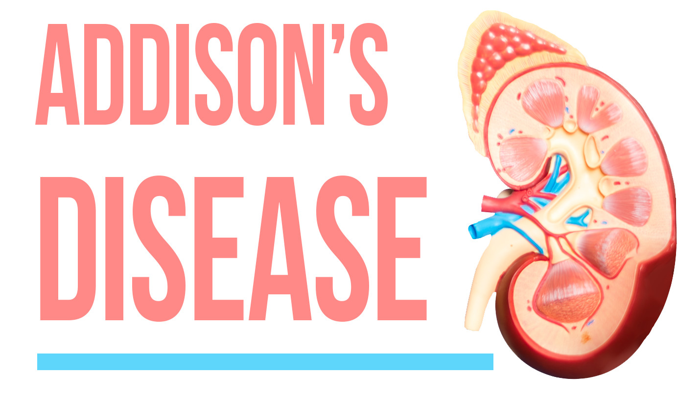 Addison’s Disease: Symptoms, Diagnosis and Treatment | HealthSoul